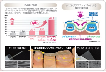 高強度硬質レジンブリッジ
